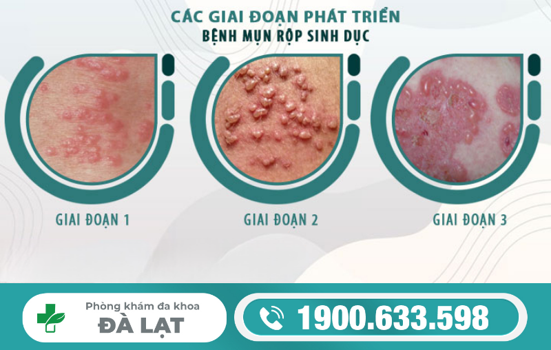 Hình ảnh minh họa